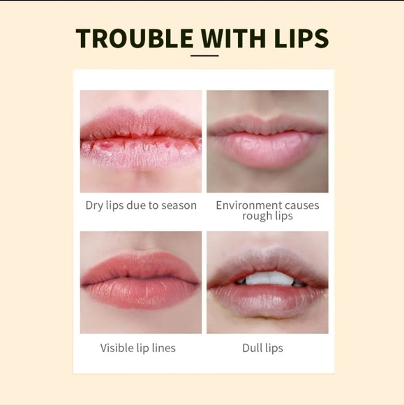 Gift box 5 tubes lip balm - Picture 6 of 7